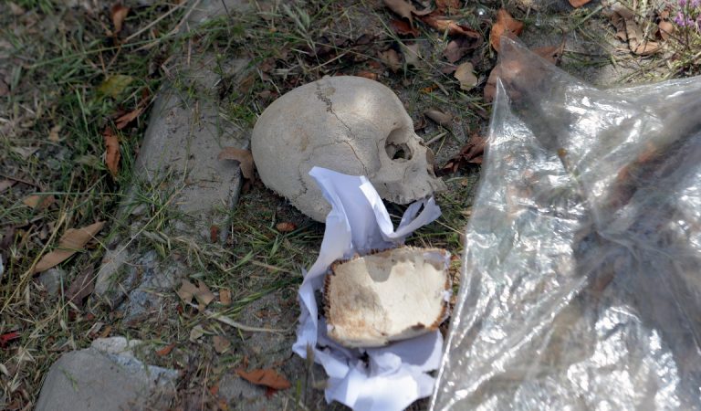Adana’da çöpte kafatası bulundu: Uzman tabibin paklık yapan eşi atmış