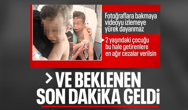 Denizli’de 2 yaşındaki bebeğe vahşeti yaşatan anne ile sevgilisi gözaltında Denizli’de 2 yaşındaki bebeğe vahşeti yaşatan anne ile sevgilisi gözaltında