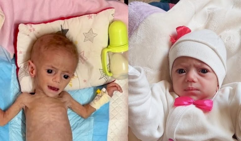 Gazze’de beş aylık Suvar Aşur, yetersiz beslenme yüzünden vefatla burun buruna